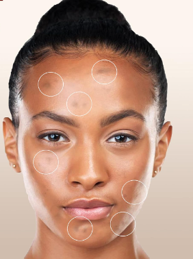 What Removes Pigmentation on Face?