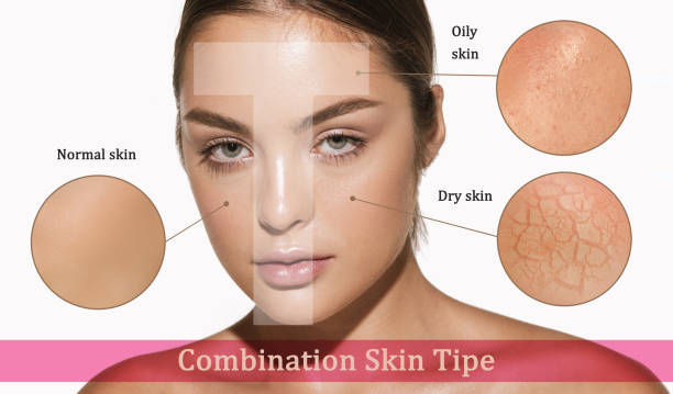 lemon to lighten skin